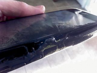 iPhone-ը պայթել է 14-ամյա աղջկա գրպանում